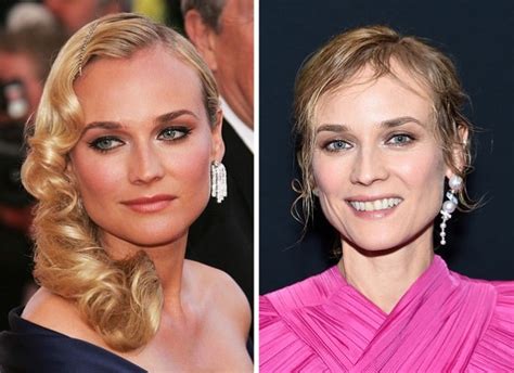 diane kruger breast implants|Diane Kruger Plastic Surgery Before and After Breast ...